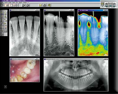 dental x-rays using diagora