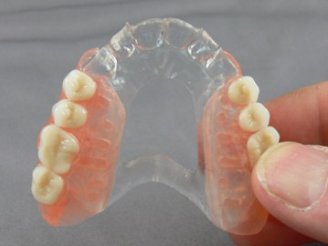 flexible denture for missing teeths