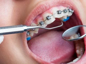 smRJ5zuURcyB0y3G5s70